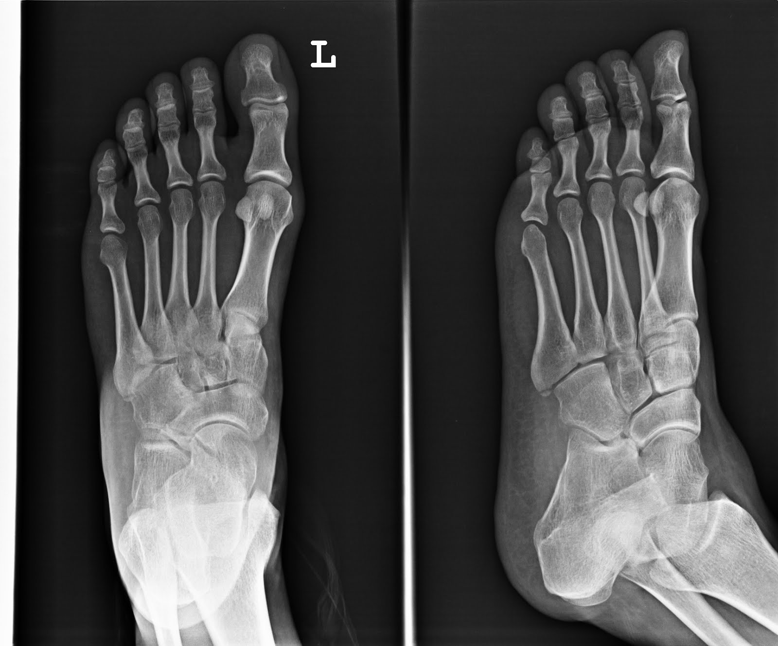 PPS Radiographs