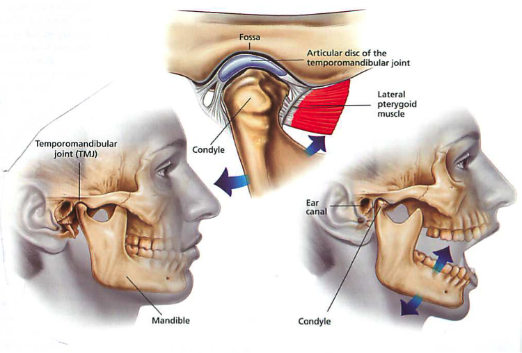 gangguan tmj GEJALA TEMPOROMANDIBULAR JOINT (TMJ)