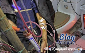 Mesin hemodialisis buatan sendiri