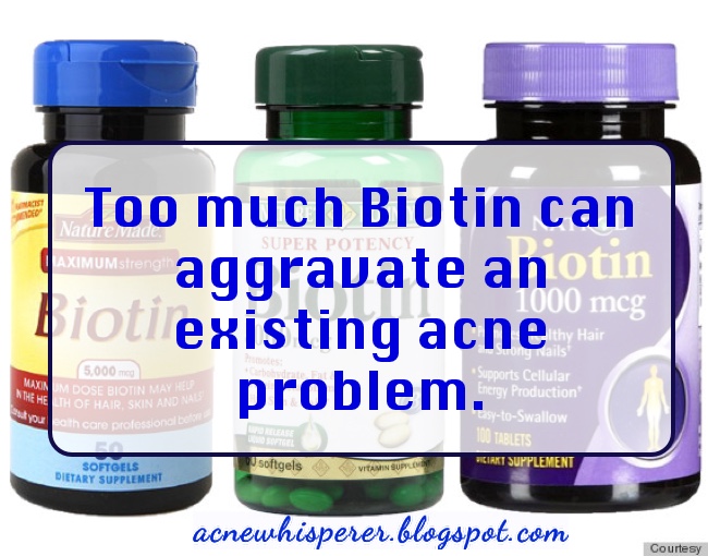 The Acne Whisperer 7 Ways to Clear Adult Backne