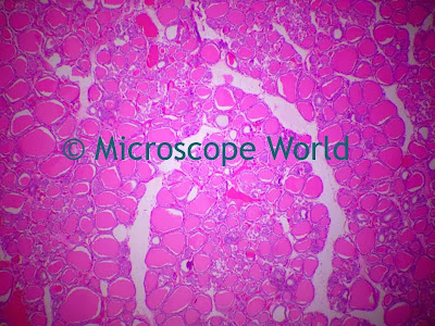 Thyroid gland captured at 100x microscope magnification.