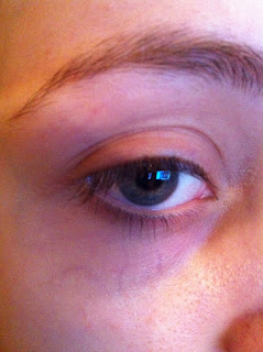under eye veins bags rid eyes
