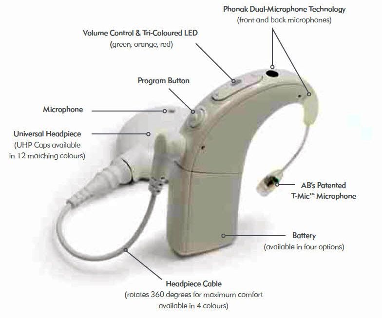 Jill's Cochlear Implant Journey What is a Cochlear Implant?