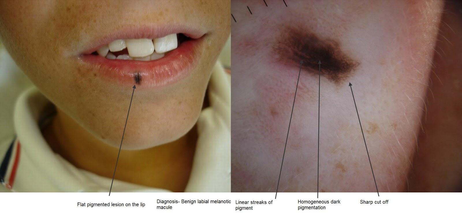 Dermatology For Dentists and Dental Students Oral Medicine for Dental