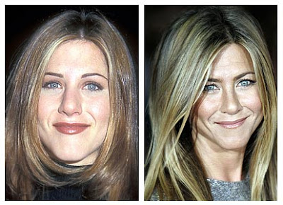 Jennifer Aniston Plastic Surgery Breast Implants Before and After Nose Job - Star Plastic