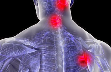 El tratamiento sheynogo de la osteocondrosis y el vértigo