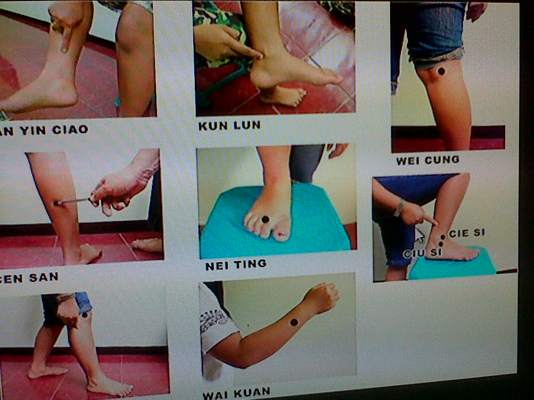 Chemistry Stanmart Pijat Refleksi Bila Lutut Sakit Dan Nyeri