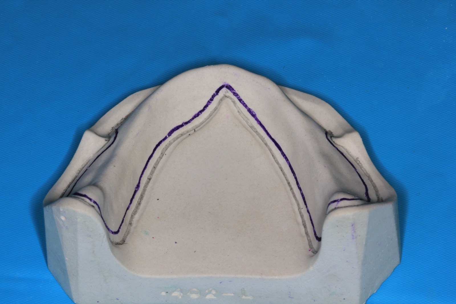 Step by step Guide for Understanding the Prosthodontics Spacer for