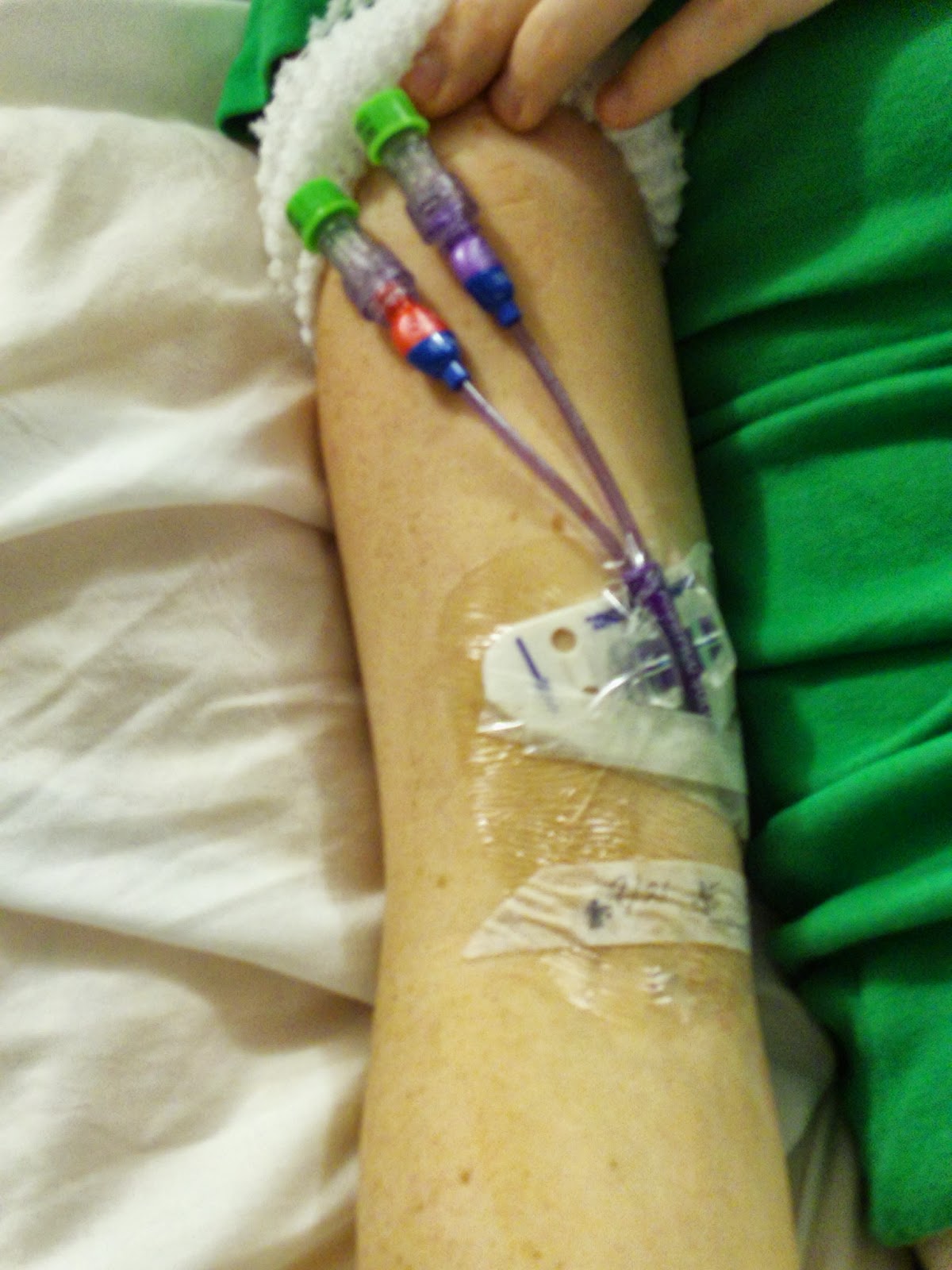 Roscoe's Story: PICC Line