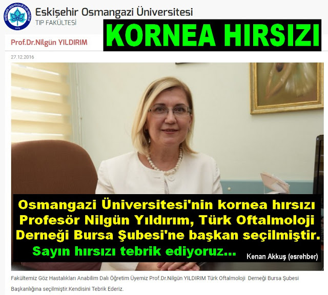 KORNEA HIRSIZLARINI DEŞİFRE ETTİKTEN SONRA....