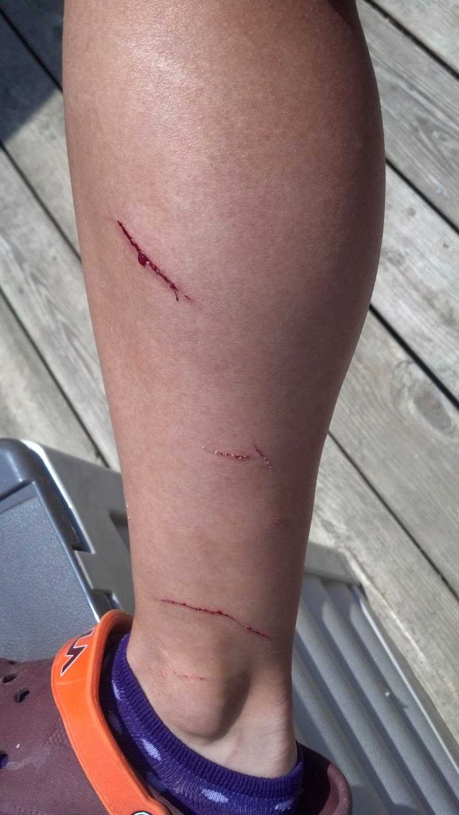 Turkey Runner Don't mess with barbed wire