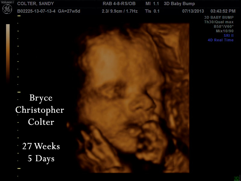 Life On The Colter Spectrum Week 27 3d Ultrasound Wow