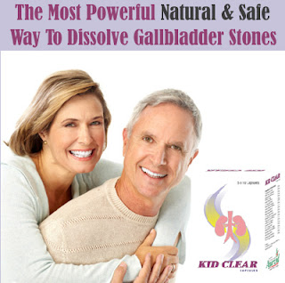 Prevent Gallstones Problem