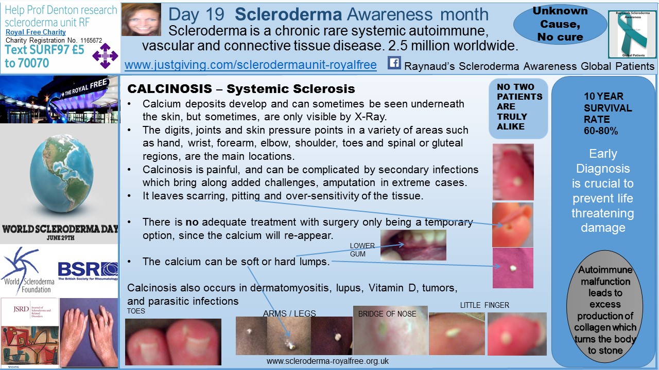 Scleroderma plaque fibrosis facial lesions
