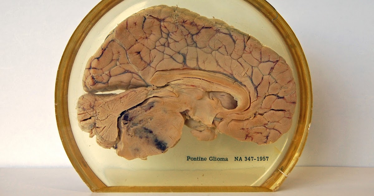 Chicago Area Medical Archivists News Percival Bailey Brain Specimens