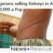 True life story of a Nigerian whose kidney was stolen in Malaysia [ Must Read ]