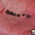 Fragmentos de meteorito golpearon en la cabeza a un niño