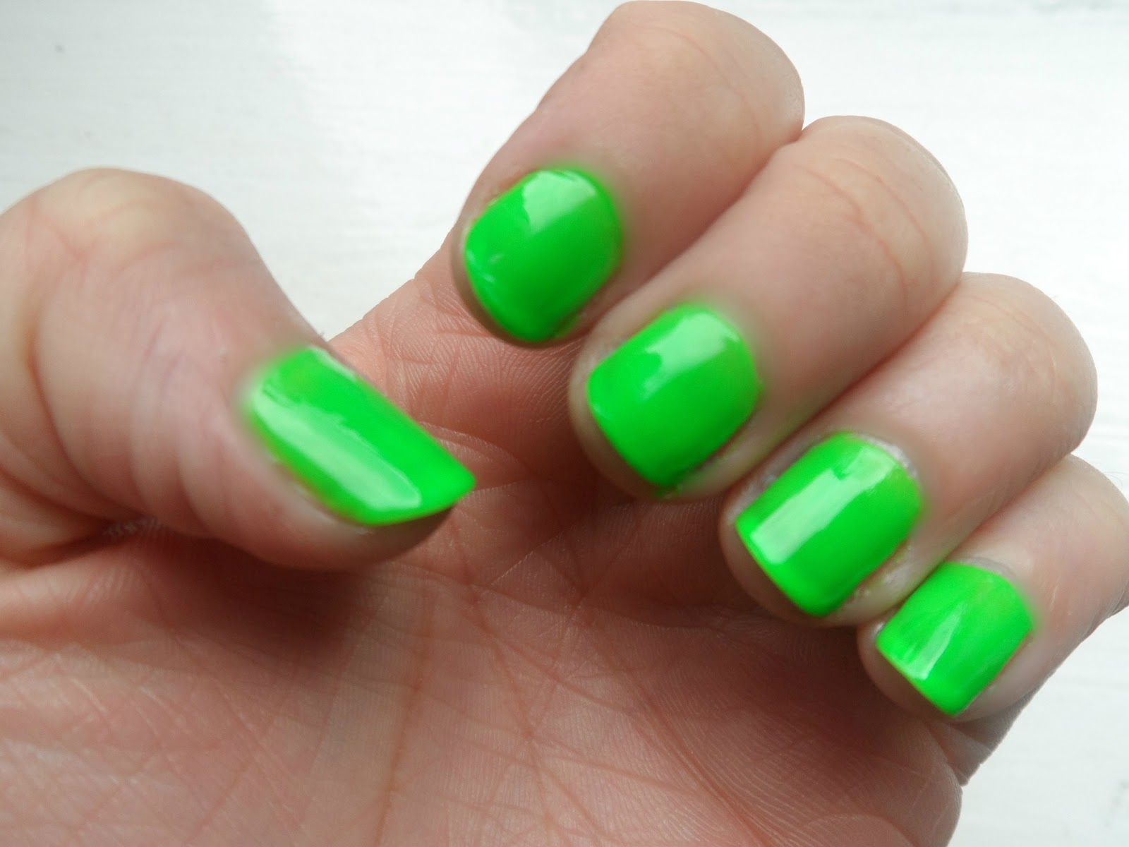 para q sirve el alopurinol 300 mg Theme Anti