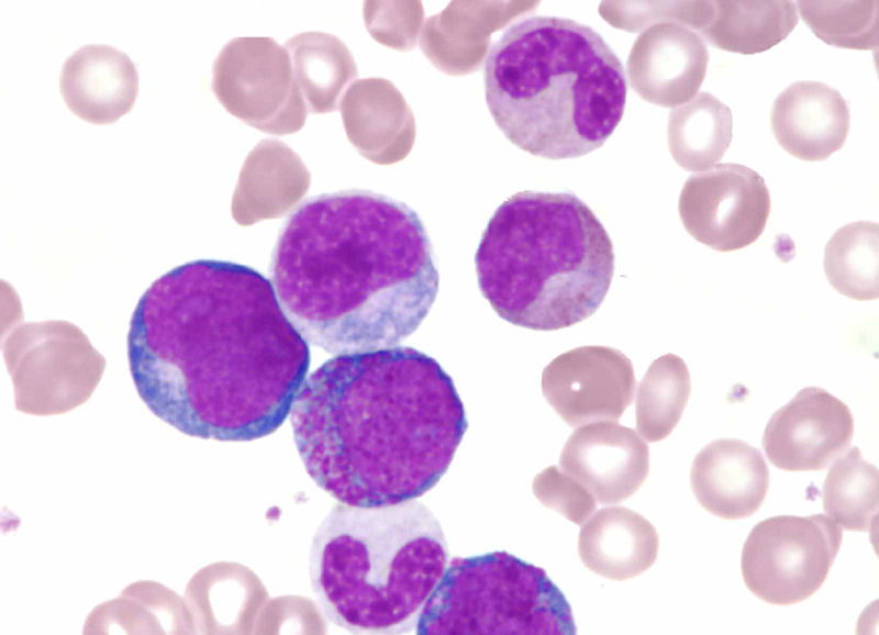 Medical Laboratory and Biomedical Science Evaluation of Automated