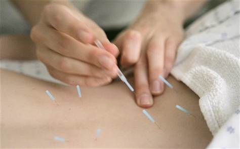 Using Acupuncture To Obtain Youthful Looking Skin