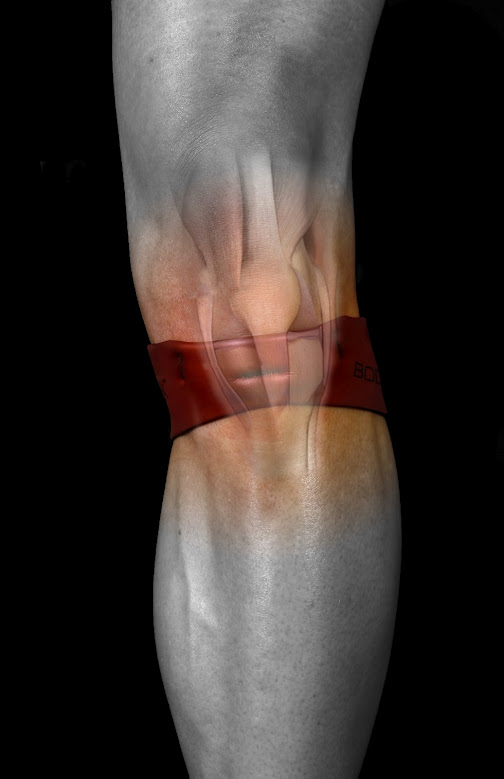 Knee Pain Under The Kneecap After Running