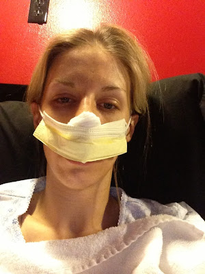 Sunshine!: My Septoplasty Experience