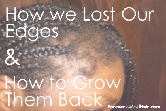 Forever Natural Hair The Story Of The Disappearing Edges