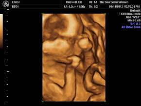 16 week 3D ultrasound- Gender Determination