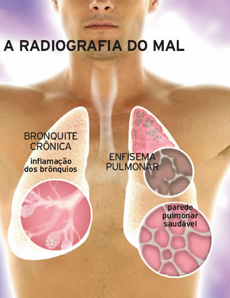 Se deixou de fumar Borodino
