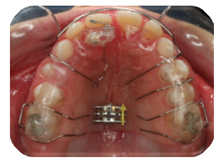 Rawatan ditawarkan yang klinik apakah pakar di ortodontik? pergigian jenis
