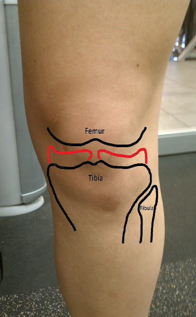 Dr. David Kwon's Blog: Ouch My Knee!! [Part 5] From Joe Shmo to Joe