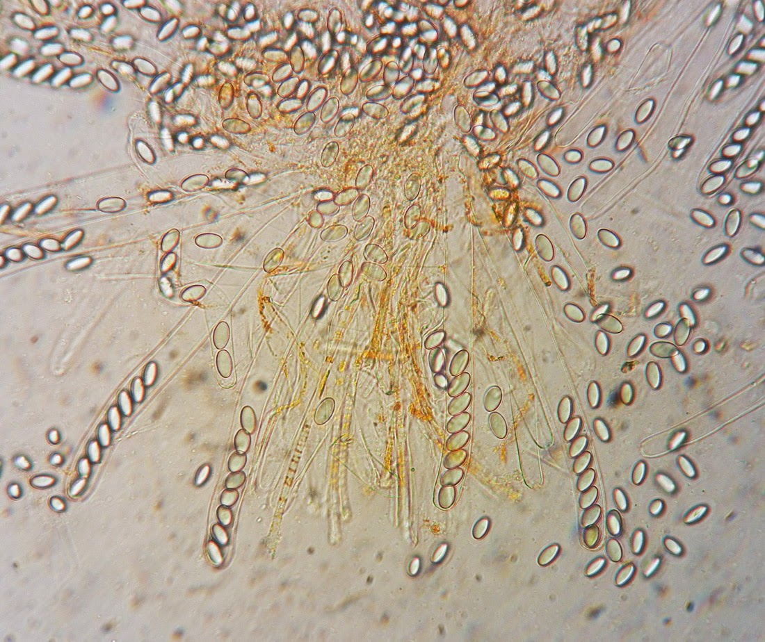 Cheilymenia stercorea spores, asci, paraphyses