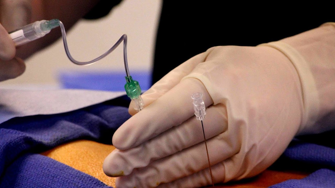 Cortisone Epidural Injection Side Effects Effect Choices