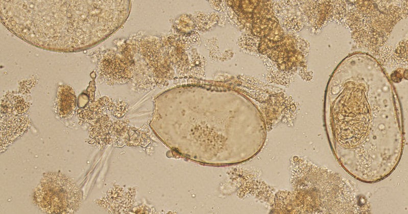 Medical Laboratory and Biomedical Science: Human Stool Parasites Challenge