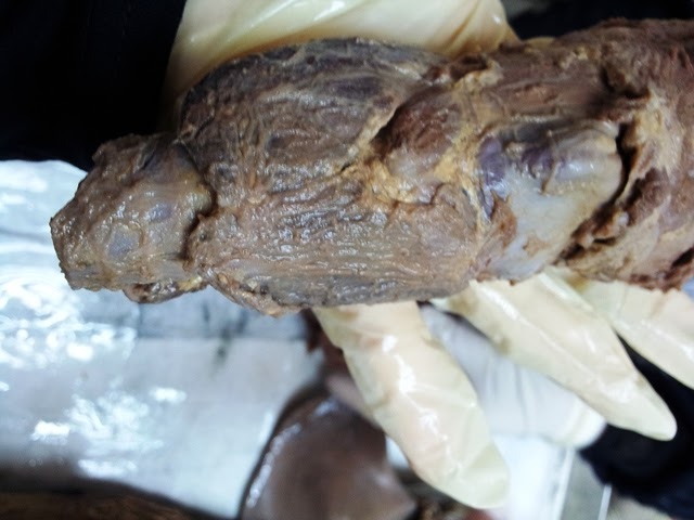 Hello! Im Cik Fatin!: Ospe Gross Anatomy (Female part, Thyroid, Tongue