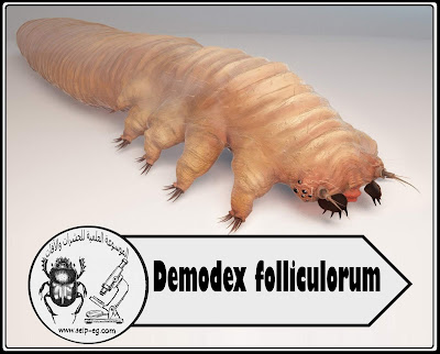 طفيل ديمودكس Demodex folliculorum (عث الوجه)