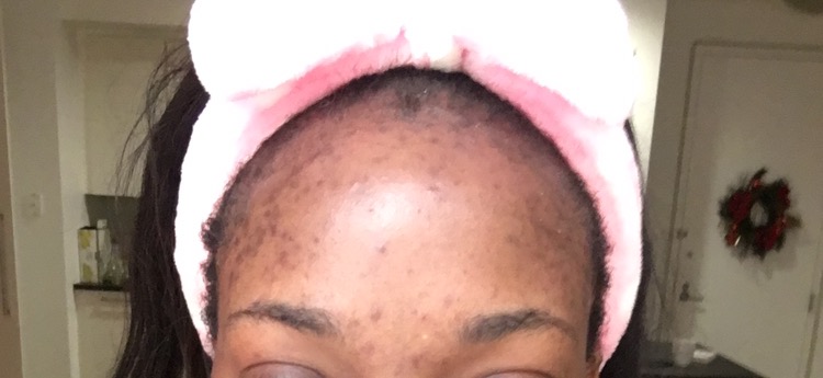 Synthetic Hair Almost Ruined My Skincare Blogger Life Skin First Daily