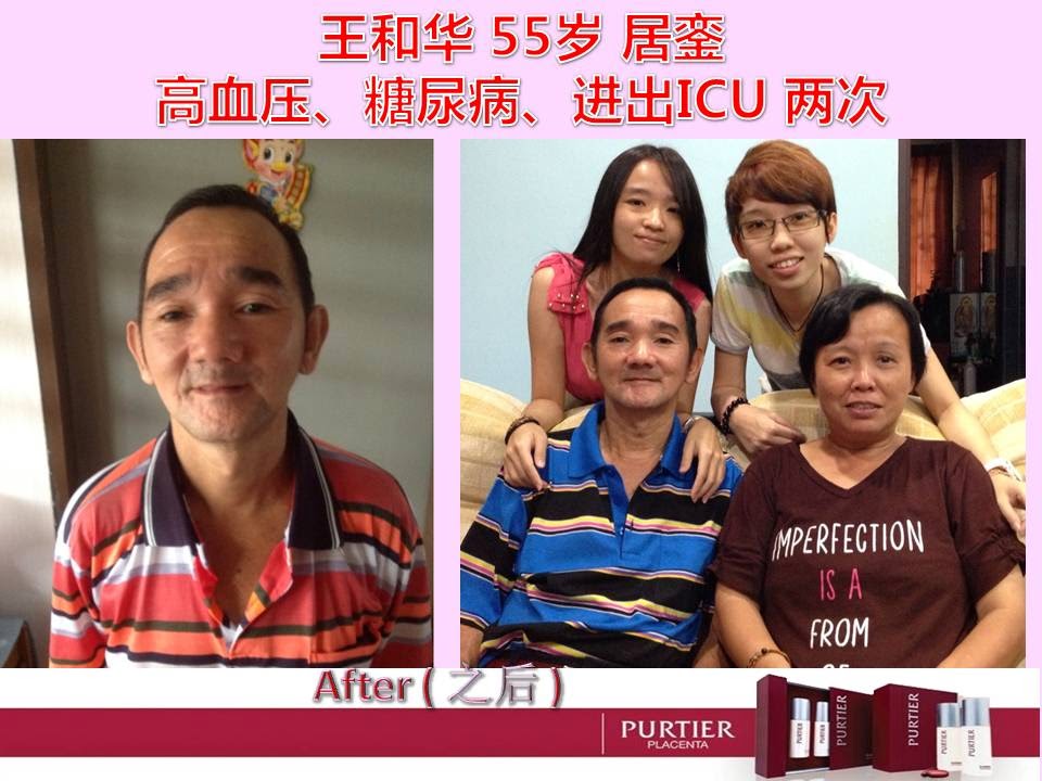 MR WONG (55) KLUANG - HIGH BLOOD PRESSURE (HYPERTENSION), DIABETES, AMITTED TO ICU 2 TIMES