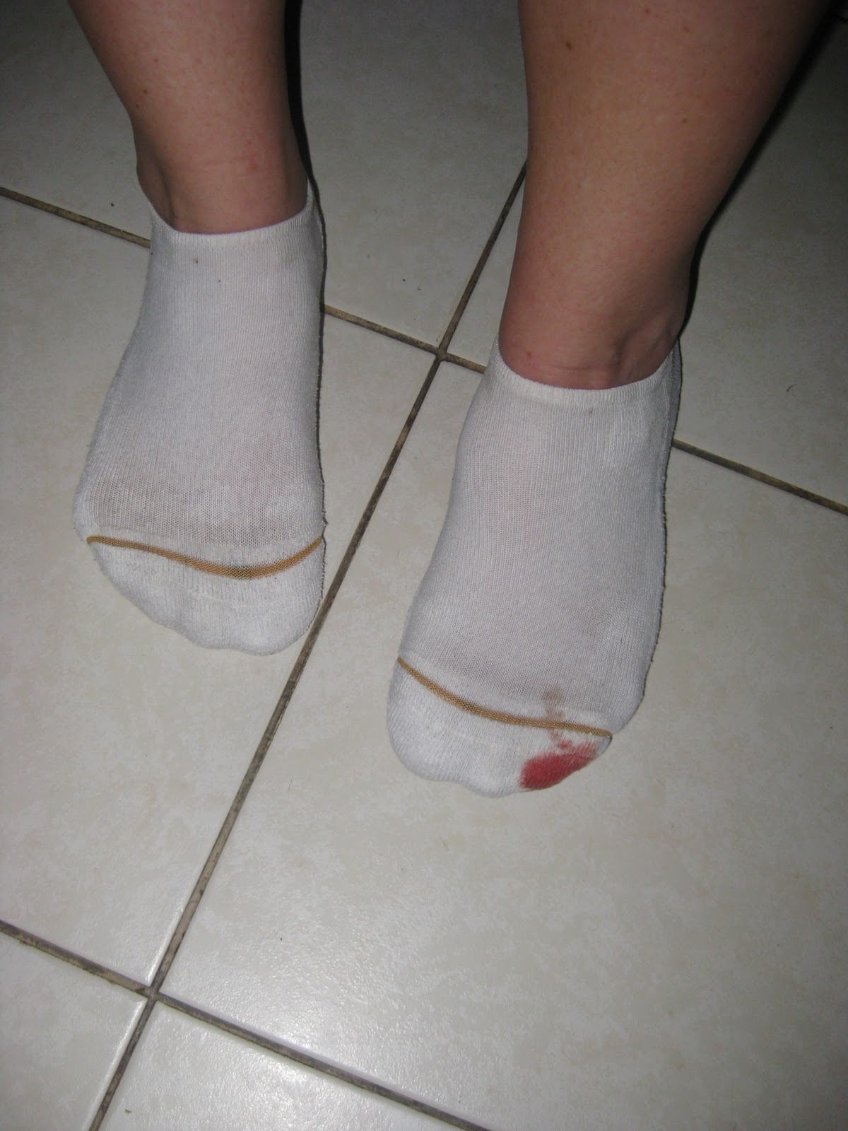 Live Fully Feet are Gross