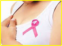 Symptoms of breast cancer in young women or women