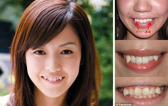 japanese girls want crooked teeth