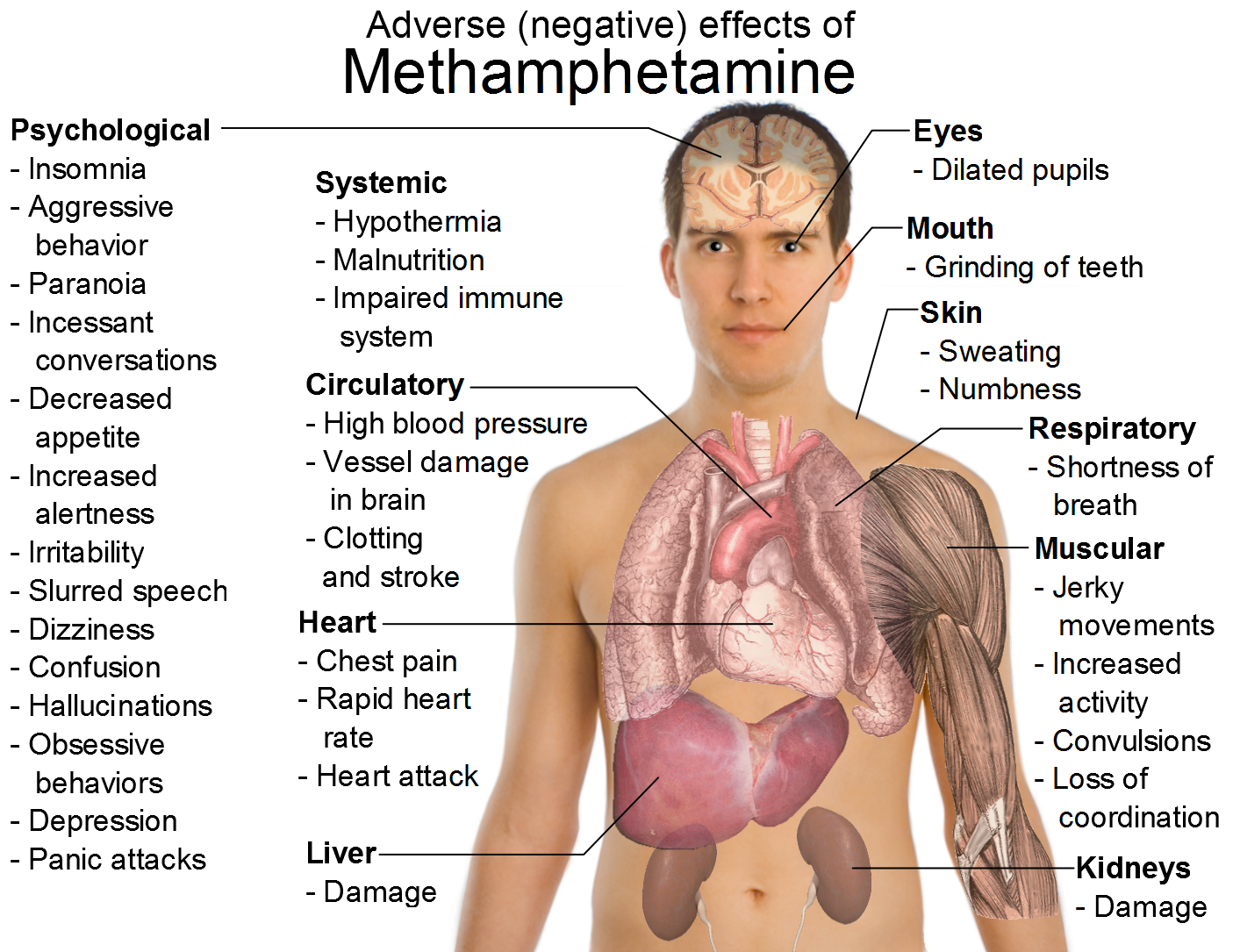 http://1.bp.blogspot.com/-m_RwozB57Vg/TeUVUIApupI/AAAAAAAAAfI/OTTgUpKQJtg/s1600/Effects_of_metamphetamine.png