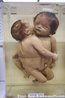 Foto Bayi Hasil kloning Manusia Yang Gagal