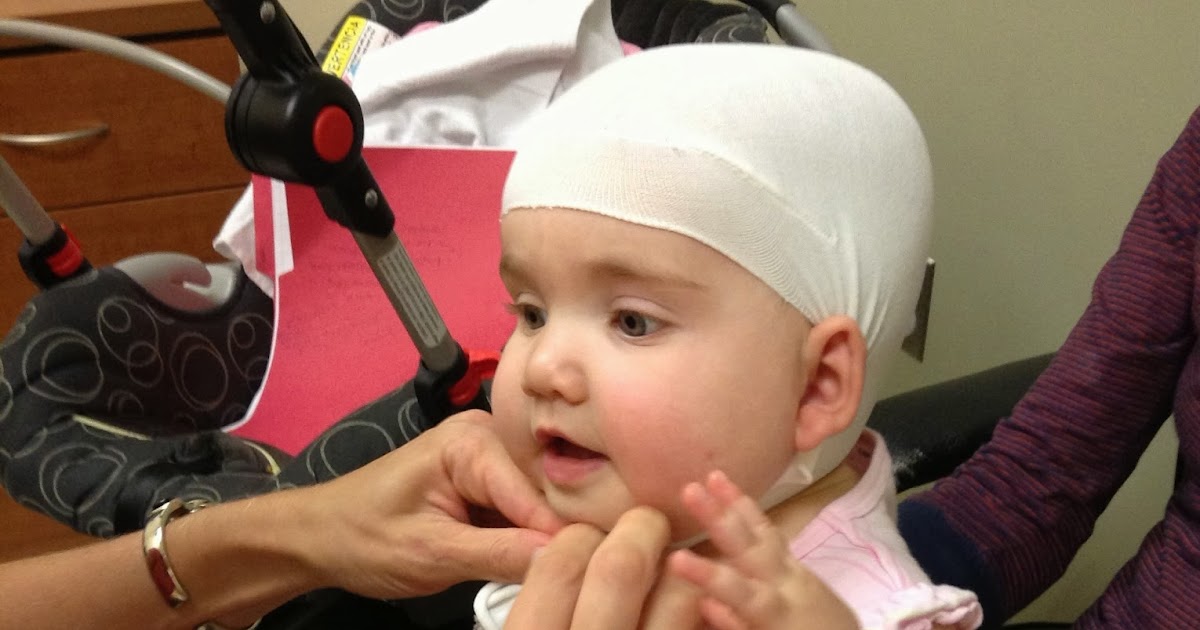 My Torticollis Baby Followup Helmet Appointment