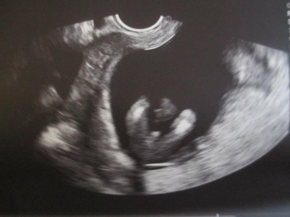 TESSA RAYANNE 16 Week Pregnancy Update, FOUR MONTHS PREGNANT