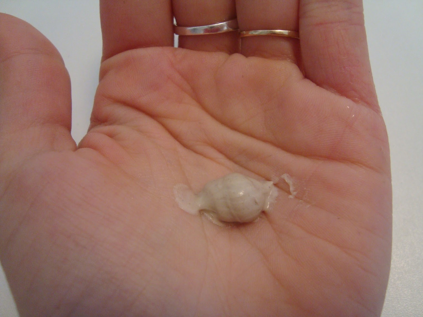 Bouton dur sous la peau Ashley Collins