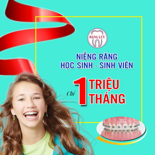 Niềng răng học sinh, sinh viên