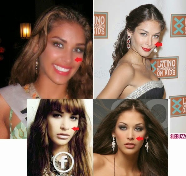 Dayana Mendoza Plastic Surgery Nose Job, Breast Implants Before and
