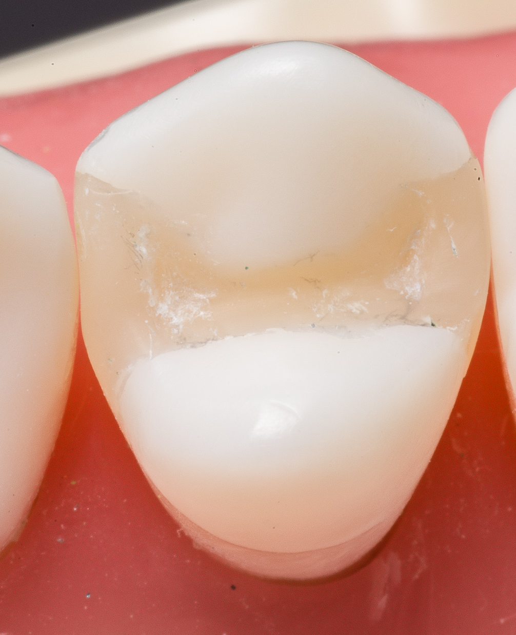 Operative EPortfolio Balandran, Steven