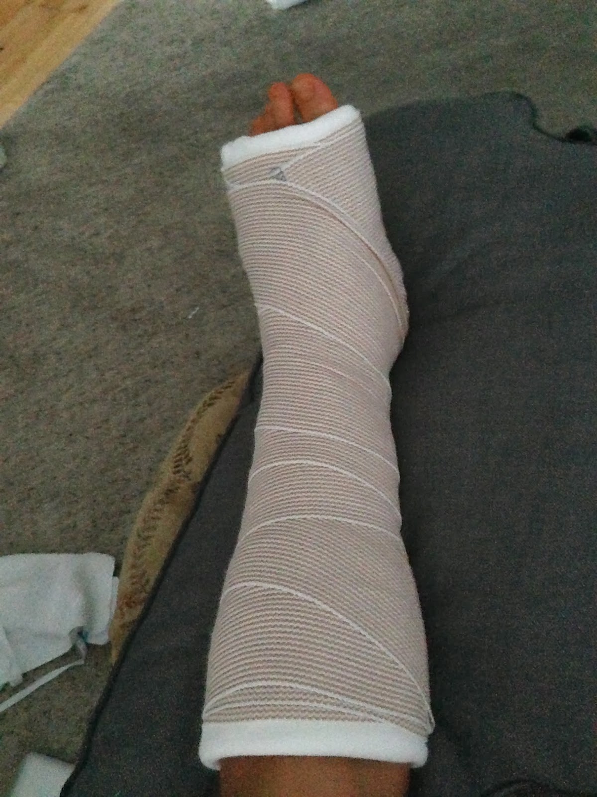 Life as an Undergrad Jones Fracture